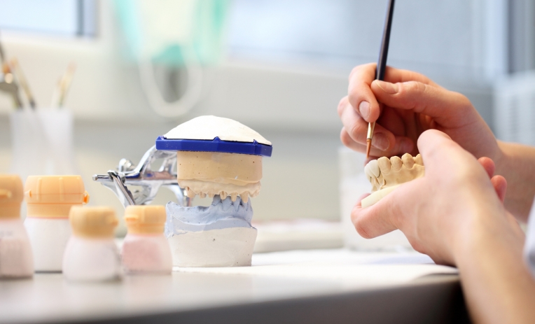 Odontotecnici: chiarimenti sull’elenco fabbricanti